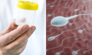 Sperm Donation in Bangalore