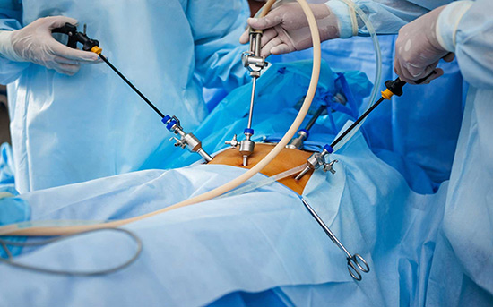 Laparoscopic Surgery In Marathahalli, Bangalore